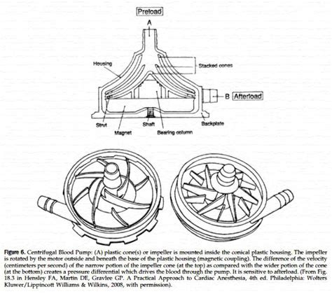 roller pump vs centrifugal pump cpb|centrifugal pump vs roller.